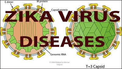 Zika Virus Disease